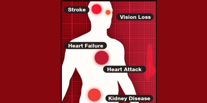 05 Risks of High Blood Pressure